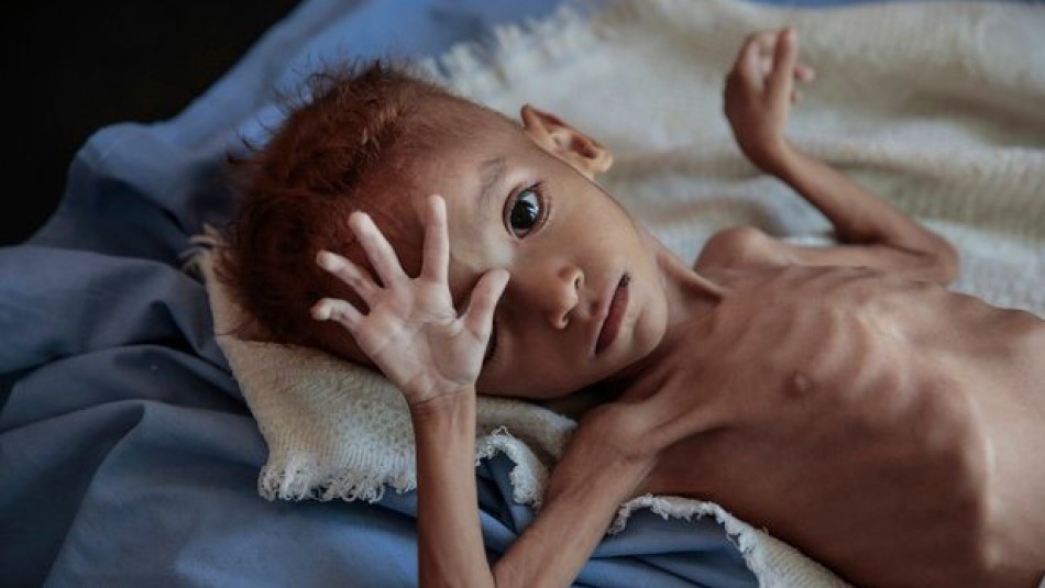 سازمان‌ملل: یمن در آستانه فاجعه عظیمی قرار دارد