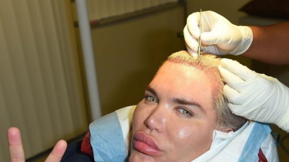 ریتم تند جراحی زیبایی در مردان