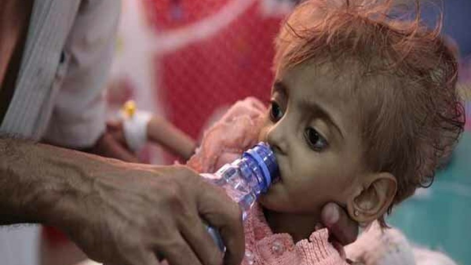 ۱۲ میلیون کودک یمنی نیازمند کمک فوری هستند