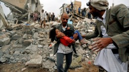 رسانه های جهان اسلام در انتشار اخبار بحران یمن کم کاری کرده اند
